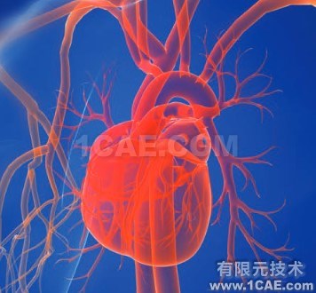 CFD模拟拯救患有致命心脏缺陷的婴儿 CFD模拟拯救患有致命心脏缺陷的婴儿