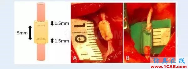 【行业观察】看制造技术如何造福人类——2017年医用3D打印技术的七个领域应用进展机械设计图例图片8